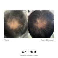 AZERUM Kopfhautserum, 100ml